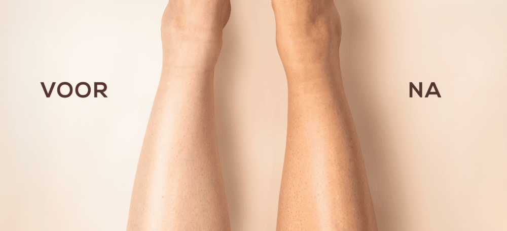 Zelfbruiner voor je benen: onthul die egale, sunkissed look